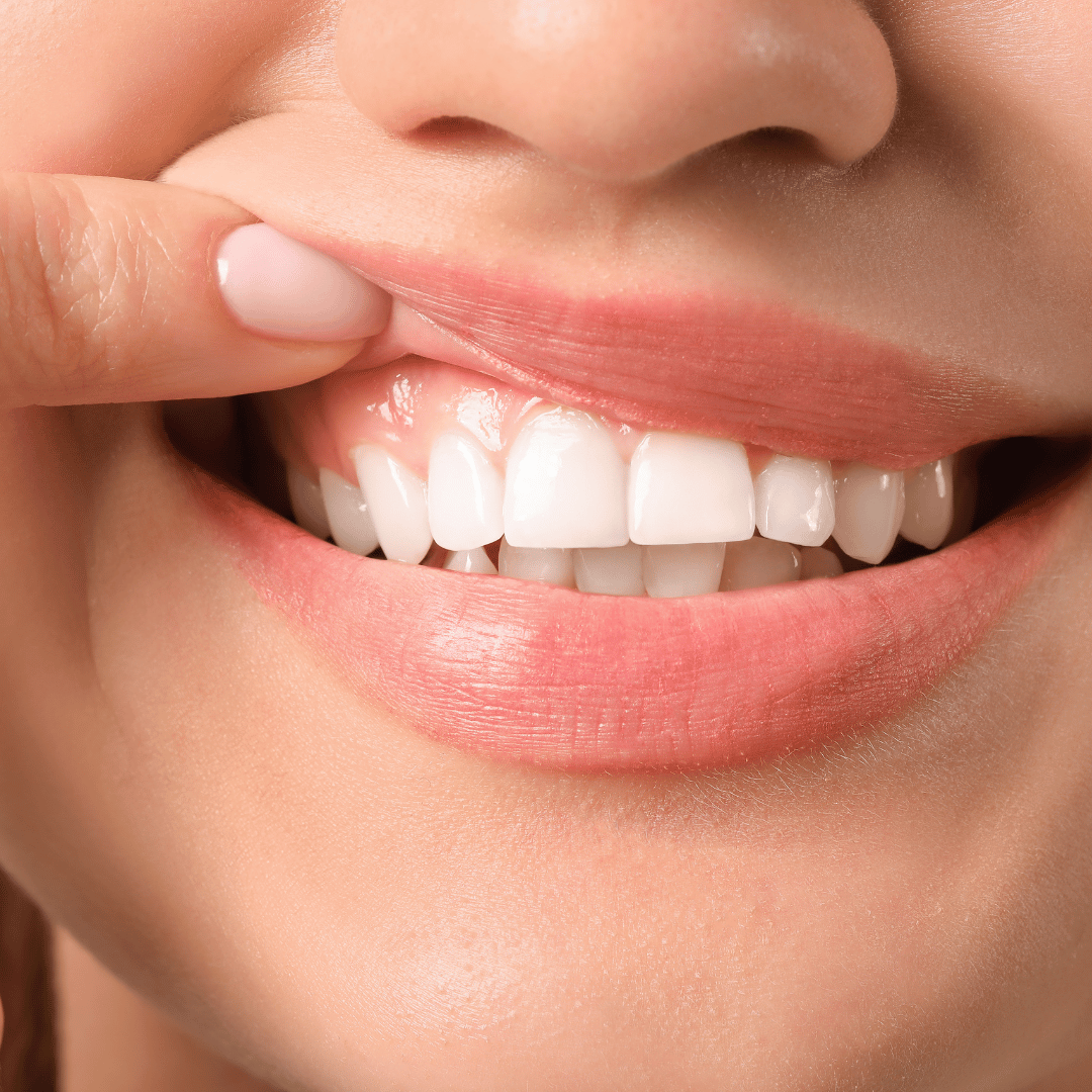 The Importance of a Balanced Oral Biome for Preventing Cavities and Gum Disease